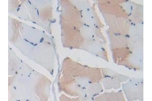 Immunohistochemistry (IHC) image for anti-Leucine Rich Repeat Containing 32 (LRRC32) (AA 162-405) antibody (ABIN7443611)