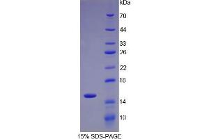 SDS-PAGE analysis of IL34 Protein. (IL-34 蛋白)