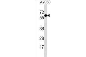 Western Blotting (WB) image for anti-Synaptotagmin IV (SYT4) antibody (ABIN3000889) (SYT4 抗体)