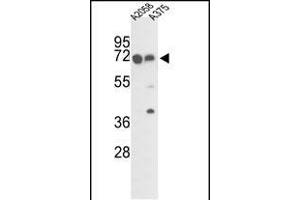 Western blot analysis of FKBP10 Antibody (C-term) (ABIN391573 and ABIN2841510) in  and  cell line lysates (35 μg/lane). (FKBP10 抗体  (C-Term))