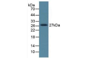 Figure. (DKK1 抗体  (AA 33-266))
