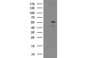 Image no. 1 for anti-Paraneoplastic Antigen MA3 (PNMA3) antibody (ABIN1500304) (PNMA3 抗体)