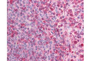 Immunohistochemistry (IHC) image for anti-Calcium Channel, Voltage-Dependent, beta 2 Subunit (CACNB2) (N-Term) antibody (ABIN6736360)