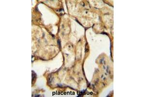 Immunohistochemistry (Paraffin-embedded Sections) (IHC (p)) image for anti-Chorionic Somatomammotropin Hormone 1 (Placental Lactogen) (CSH1) (AA 180-208), (C-Term) antibody (ABIN954170)