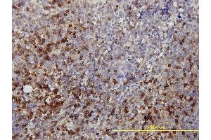 Immunoperoxidase of monoclonal antibody to LDHB on formalin-fixed paraffin-embedded human tonsil tissue. (LDHB 抗体  (AA 1-334))
