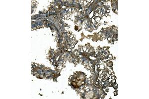 IHC analysis of IFT88 using anti-IFT88 antibody (ABIN7600458).