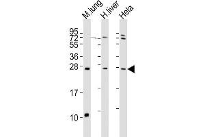All lanes : Anti-SOST Antibody (N-term) at 1:2000 dilution Lane 1: mouse lung lysates Lane 2: human liver lysates Lane 3: Hela whole cell lysates Lysates/proteins at 20 μg per lane. (Sclerostin 抗体  (N-Term))
