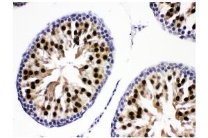 IHC analysis of KDM5B using anti-KDM5B antibody (ABIN4886648).