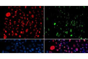 Immunofluorescence analysis of GFP-RNF168 transgenic U2OS cells using Phospho-SMC1A(S957) Polyclonal Antibody (SMC1A 抗体  (pSer957))