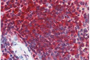 Immunohistochemistry (IHC) image for anti-Enolase 1 (ENO1) (AA 246-295) antibody (ABIN6748542)