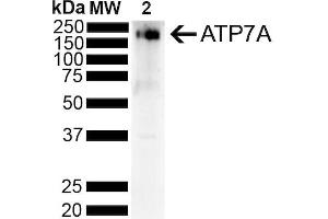 Western Blot analysis of Rat Liver showing detection of ~180 kDa Copper Transporting ATPase 1 protein using Mouse Anti-Copper Transporting ATPase 1 Monoclonal Antibody, Clone S60-4 (ABIN2485181).