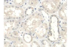 Immunohistochemistry (IHC) image for anti-UDP-Glucose Ceramide Glucosyltransferase (UGCG) (AA 39-171) antibody (ABIN7443101)
