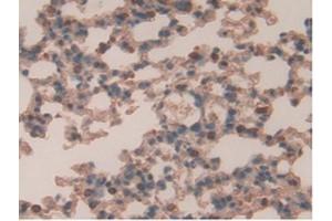 IHC-P analysis of Mouse Lung Tissue, with DAB staining. (Retinoic Acid Receptor alpha 抗体  (AA 237-459))