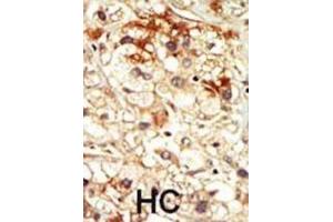 Immunohistochemistry (IHC) image for anti-Cyclin-Dependent Kinase 17 (CDK17) antibody (ABIN3003281)