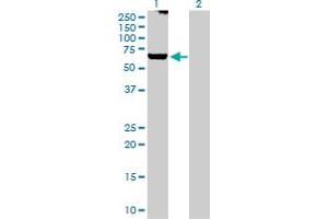 Western Blot analysis of GRK6 expression in transfected 293T cell line by GRK6 MaxPab polyclonal antibody. (GRK6 抗体  (AA 1-589))