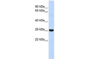 WB Suggested Anti-HOXB8 Antibody Titration: 0. (HOXB8 抗体  (N-Term))