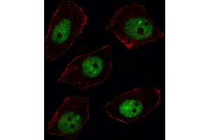 Immunofluorescence (IF) image for anti-Sorbin and SH3 Domain Containing 2 (Sorbs2) (AA 175-204), (N-Term) antibody (ABIN652279)