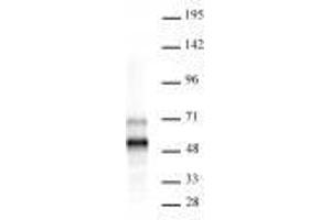 MEIS 1/2/3 antibody (rAb) tested by Western blot. (Recombinant MEIS1/MEIS2/MEIS3 (AA 59-390) 抗体)