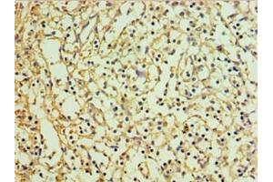 Immunohistochemistry of paraffin-embedded human spleen tissue using ABIN7151129 at dilution of 1:100 (RNF125 抗体  (AA 1-232))