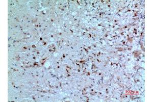 Immunohistochemistry (IHC) analysis of paraffin-embedded Human Brain, antibody was diluted at 1:100. (Thymidine Phosphorylase 抗体  (N-Term))