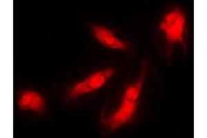 Immunofluorescent analysis of p35 staining in HeLa cells. (CDK5R1 抗体  (N-Term))