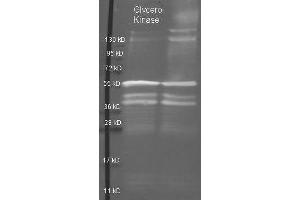 Goat anti Glycerol Kinase antibody  was used to detect purified Glycerol Kinase under reducing (R) and non-reducing (NR) conditions. (Glycerol Kinase 抗体)
