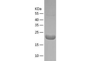 Western Blotting (WB) image for Ubiquitin-Conjugating Enzyme E2G 2 (UBE2G2) (AA 1-165) protein (His tag) (ABIN7286599) (UBE2G2 Protein (AA 1-165) (His tag))