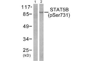 Western Blotting (WB) image for anti-Signal Transducer and Activator of Transcription 5B (STAT5B) (pSer731) antibody (ABIN1847250) (STAT5B 抗体  (pSer731))