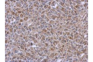 IHC-P Image Immunohistochemical analysis of paraffin-embedded RT2 xenograft, using DLST, antibody at 1:500 dilution. (DLST 抗体  (Center))