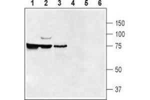 Western blot analysis of rat kidney (lanes 1 and 4), mouse brain (lanes 2 and 5) and rat testis (lanes 3 and 6): - 1-3. (SLC47A1 抗体  (5th Cytoplasmic Loop))