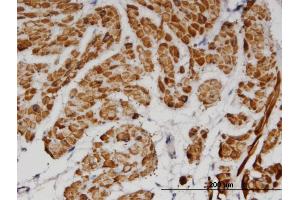 Immunoperoxidase of monoclonal antibody to TPM2 on formalin-fixed paraffin-embedded human smooth muscle. (TPM2 抗体  (AA 1-284))