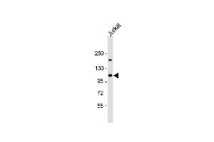Anti-UBL Antibody (Center) at 1:1000 dilution + Jurkat whole cell lysate Lysates/proteins at 20 μg per lane. (UBAP2L 抗体  (AA 575-601))