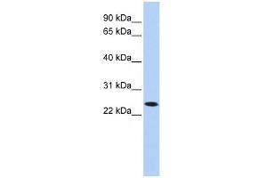 KLRA1 antibody used at 1 ug/ml to detect target protein. (KLRA1 抗体  (N-Term))