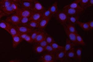 IF analysis of NFkB p105/p50/NFKB1 using anti-NFkB p105/p50/NFKB1 antibody (ABIN3043587).