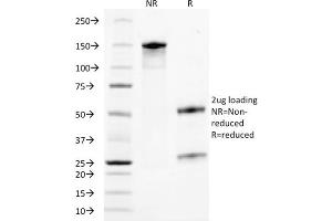 SDS-PAGE Analysis Purified TACSTD2-Monospecific Mouse Monoclonal Antibody (TACSTD2/2153). (TACSTD2 抗体  (AA 31-274))