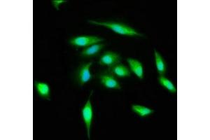 Immunofluorescence staining of Hela cells with ABIN7174567 at 1:400, counter-stained with DAPI. (ATG3 抗体  (AA 1-314))