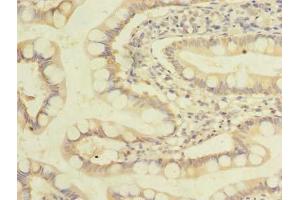 Immunohistochemistry (IHC) image for anti-Zinc Finger, DHHC-Type Containing 3 (ZDHHC3) (AA 94-171) antibody (ABIN7162550)
