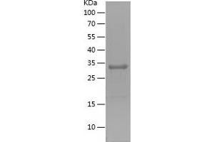 ZKSCAN3 Protein (AA 1-248) (His tag)