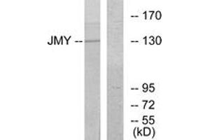 Western blot analysis of extracts from COLO cells, using JMY Antibody.
