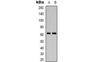 Western blot analysis of CD19 expression in Jurkat (A), mouse brain (B) whole cell lysates. (CD19 抗体)