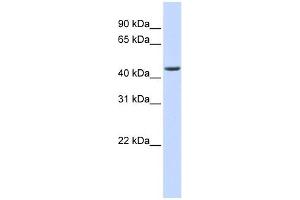 ELAC1 antibody used at 1 ug/ml to detect target protein. (ELAC1 抗体)