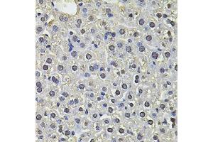 Immunohistochemistry of paraffin-embedded mouse liver using SP110 Antibody (ABIN6290941) at dilution of 1:100 (40x lens). (SP110 抗体)