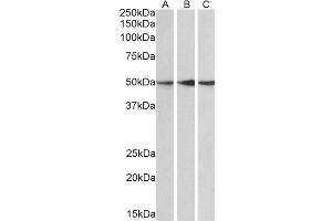 ABIN184647 (0. (PPP2R5E 抗体  (C-Term))
