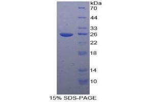 SDS-PAGE analysis of Human TICAM2 Protein. (ICAM2 蛋白)