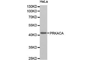 Western blot analysis of extracts of HeLa cell line, using PRKACA antibody. (PRKACA 抗体)
