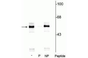 Western blot of rat brainstem lysate showing specific immunolabeling of the ~55 kDa TPH protein phosphorylated at Ser260 in lane one (-). (Tryptophan Hydroxylase 1 抗体  (pSer260))
