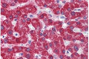 Human Liver: Formalin-Fixed, Paraffin-Embedded (FFPE) (Monoamine Oxidase B 抗体  (AA 36-85))