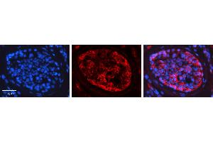 Rabbit Anti-PRKCZ Antibody   Formalin Fixed Paraffin Embedded Tissue: Human Testis Tissue Observed Staining: Cytoplasm Primary Antibody Concentration: 1:600 Other Working Concentrations: N/A Secondary Antibody: Donkey anti-Rabbit-Cy3 Secondary Antibody Concentration: 1:200 Magnification: 20X Exposure Time: 0. (PKC zeta 抗体  (N-Term))