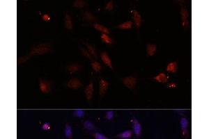 Immunofluorescence analysis of NIH/3T3 cells using c-Fos Polyclonal Antibody at dilution of 1:100. (c-FOS 抗体)