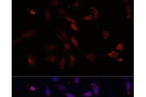 Immunofluorescence analysis of NIH/3T3 cells using c-Fos Polyclonal Antibody at dilution of 1:100. (c-FOS 抗体)